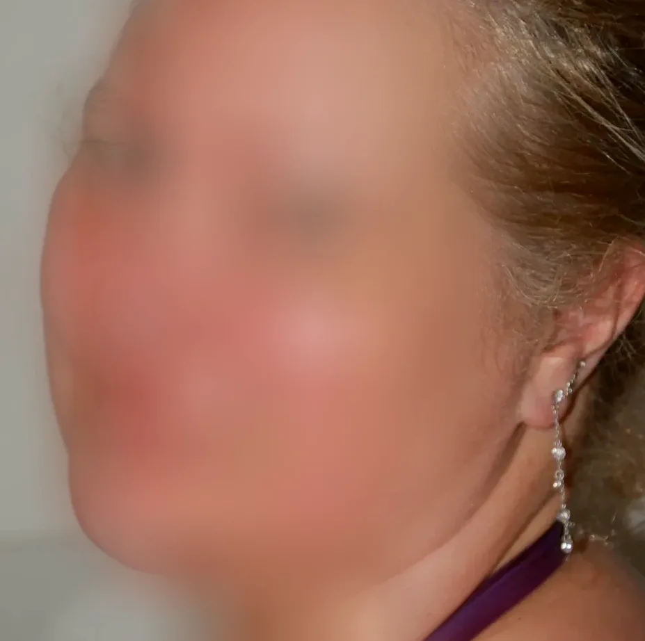 Gemma, 28